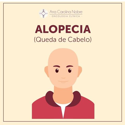 Alopecia Alopecia: Vou fazer quimioterapia? Meu cabelo vai cair?